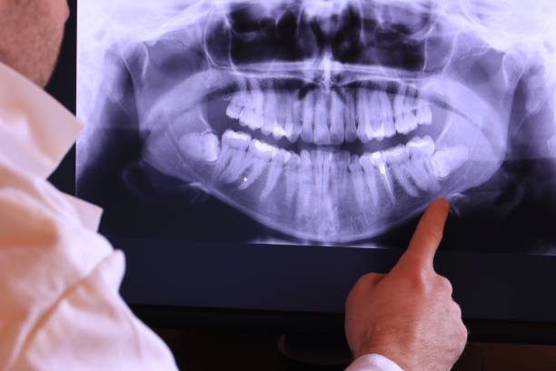 Best Emergency Treatment for Dental Infections or Abscesses in Sto Brook University, NY